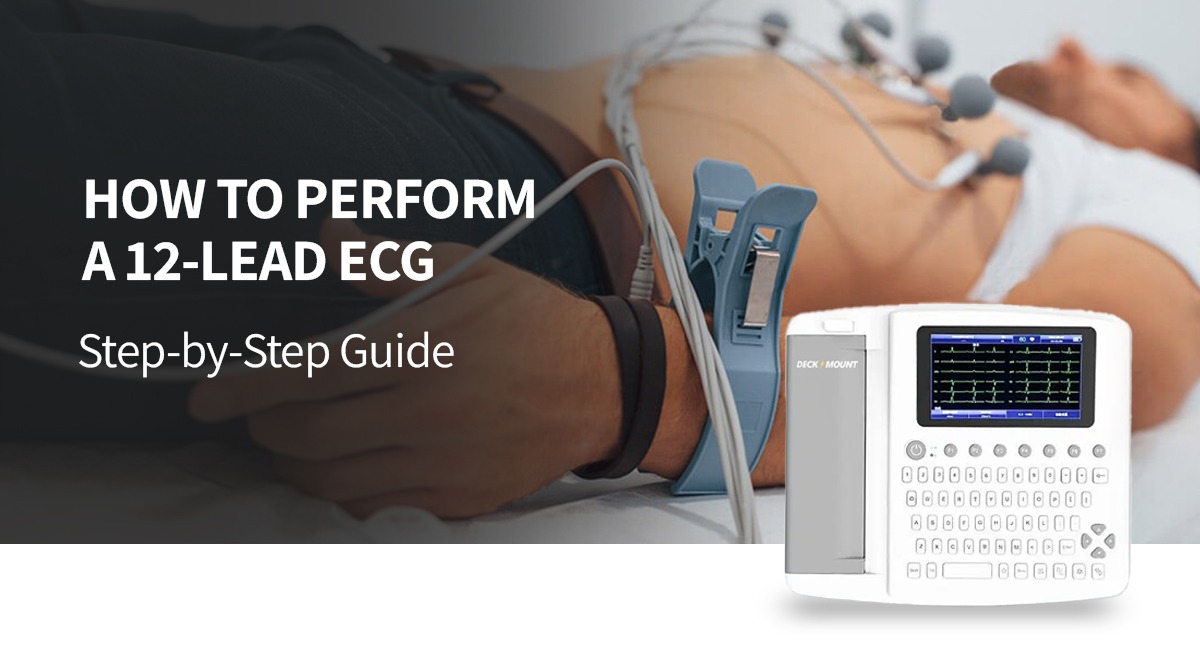  How to Perform a 12-Lead ECG: Step-by-Step Guide - Deck Mount